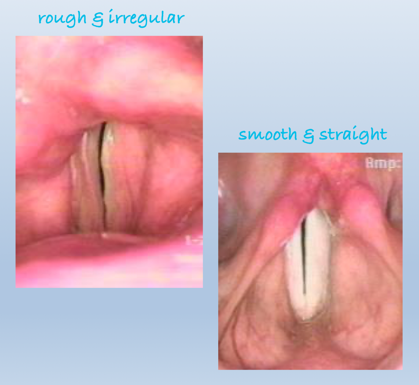 <ul><li><p>smooth &amp; straight </p></li><li><p>rough &amp; irregular </p></li></ul><p></p>