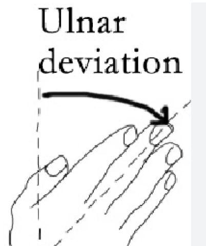 <p>Ulnar/Radial Deviation</p>