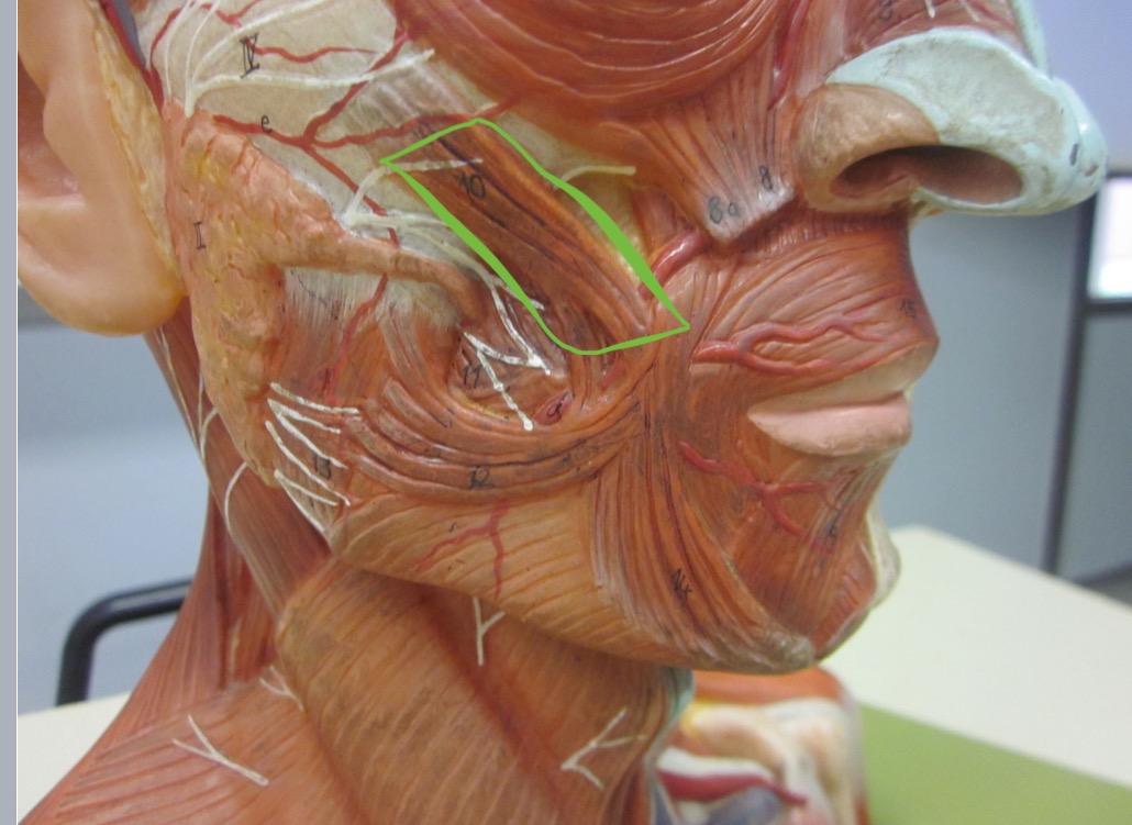 <p>Which muscle</p>