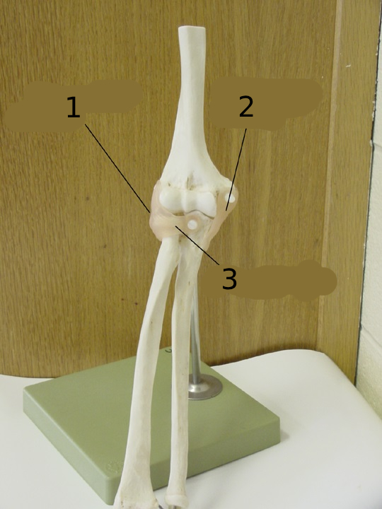 <p>#1</p>