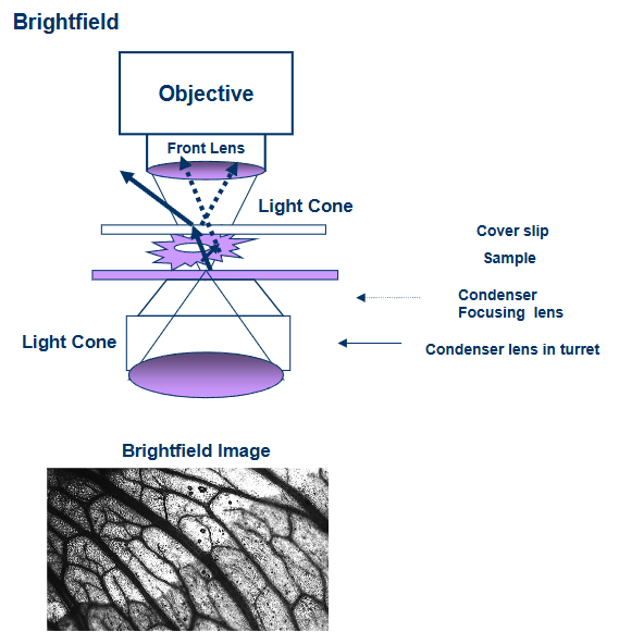 <p>image formed when the undeviated background light is focused in the same image plane as the deviated light from the sample and interference takes place</p>