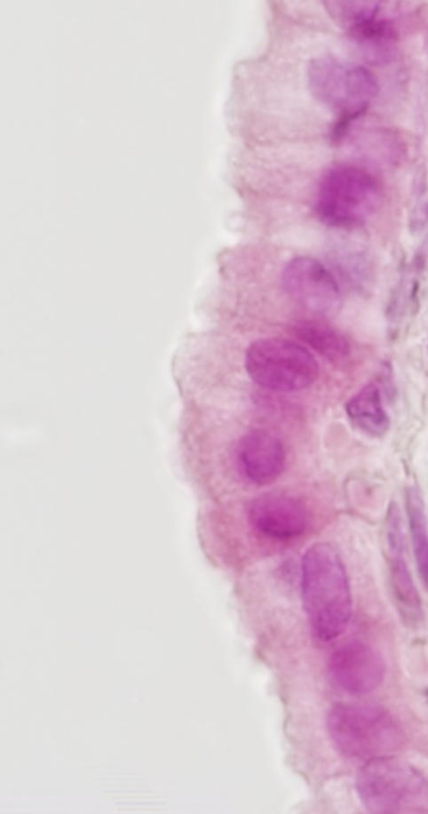 <p>Angiv galdeblærens epitheltype og overfladespecialisering</p>