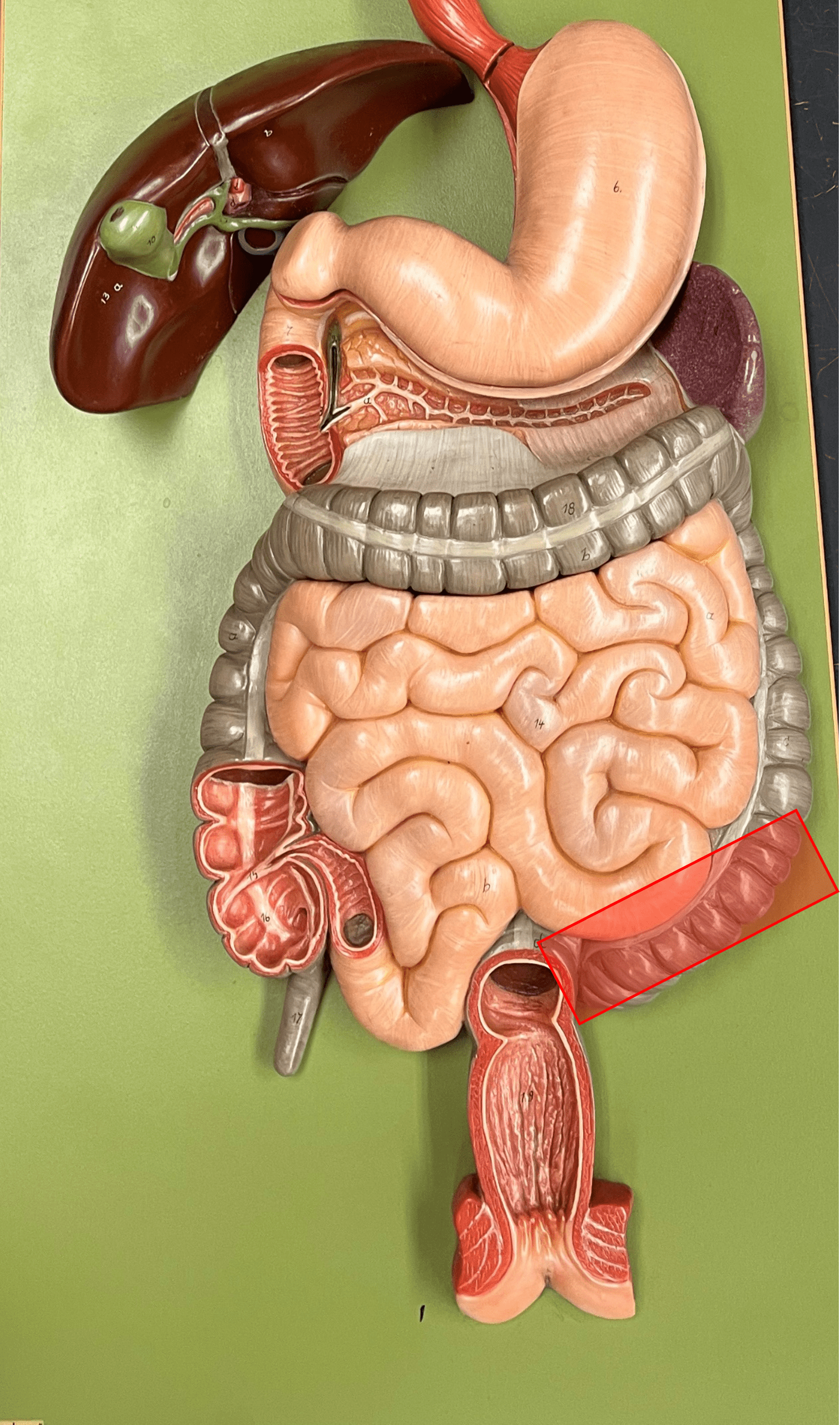 • The fourth part of the colon of the large intestine.

• The S-shaped segment at the level of the iliac crest.