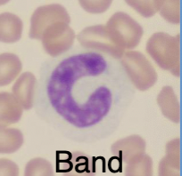 What kind of leukocyte is this?