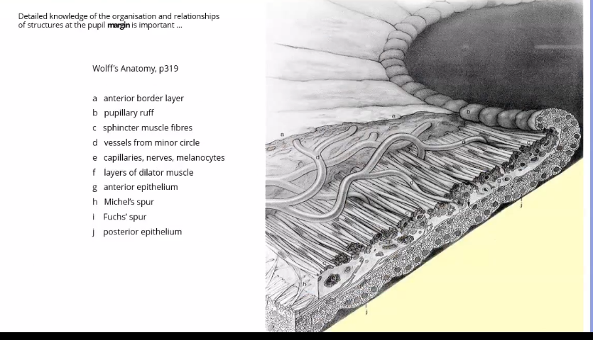 <p>pupillary margin of the iris </p>