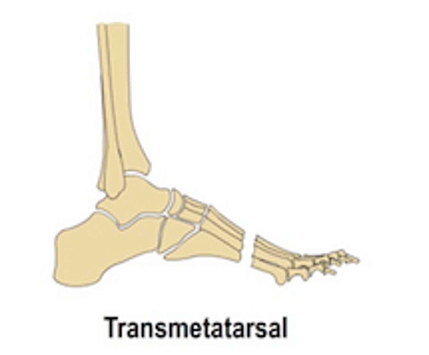 <p>Transmetatarsal</p>
