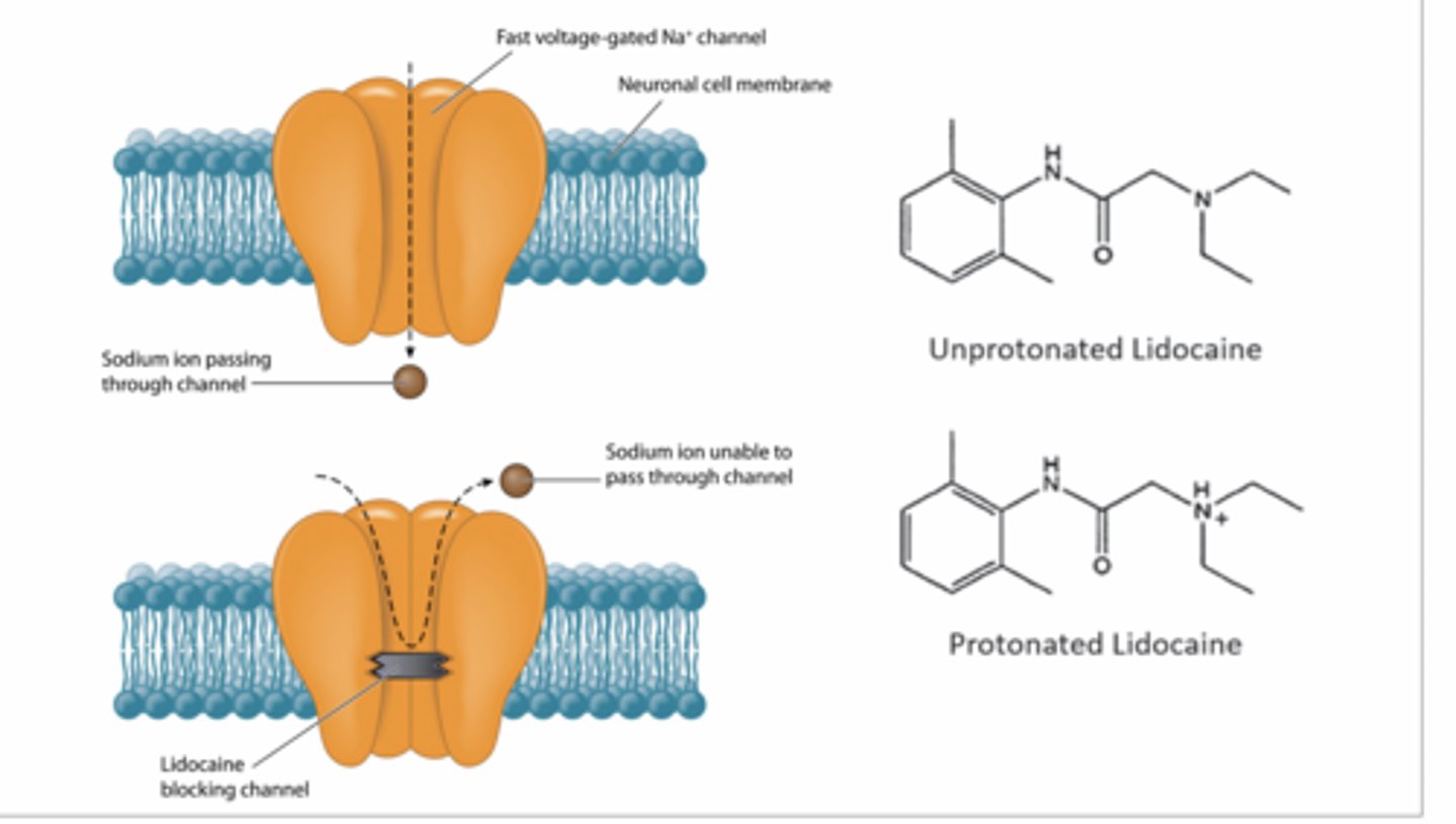 <p>lidocaine, </p><p>Uncharged lidocaine diffuses into neuron</p><p>Becomes protonated (charged) inside</p><p>Binds inside Na⁺ channel</p><p>Physically blocks Na⁺ entry</p><p>Ach cant enter</p><p>No depolarization AND NO nerve signal</p><p>GENERAL ANESTHETICS</p><p>Don’t block one specific protein — they mess with the membrane itself</p><p>Mechanism:</p><p>Insert into lipid bilayer</p><p>Change:</p><p>membrane fluidity</p><p>membrane pressure</p><p>This alters ion channel shape → channels don’t open properly</p><p>Reduced neural activity (brain-wide)</p><p>WHY LOPIDINE HELPS</p><p>Botox paralyzes levator palpebrae (skeletal muscle)</p><p>Lopidine activates smooth muscle (tarsus superior)</p><p>Mechanism:</p><p>α-adrenergic agonist (GPCR)</p><p>Causes contraction → lifts eyelid slightly (~2 mm)</p>