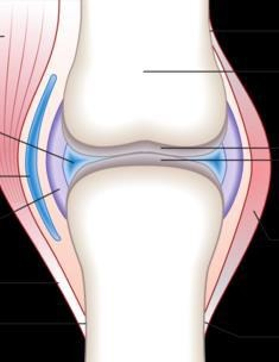 <p>diarthrosis with synovial cavity and synovial fluid between bones, supported by ligament</p>
