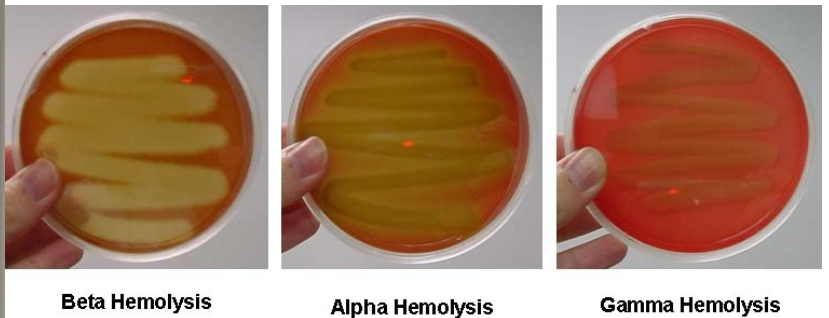 <p>Tests hemolytic properties</p><p>- Alpha: Partial lysis of red blood cells (looks bruised)</p><p>- Beta: Complete lysis of red blood cells (zone of clearance)</p><p>- Gamma: No lysis of red blood cells</p>