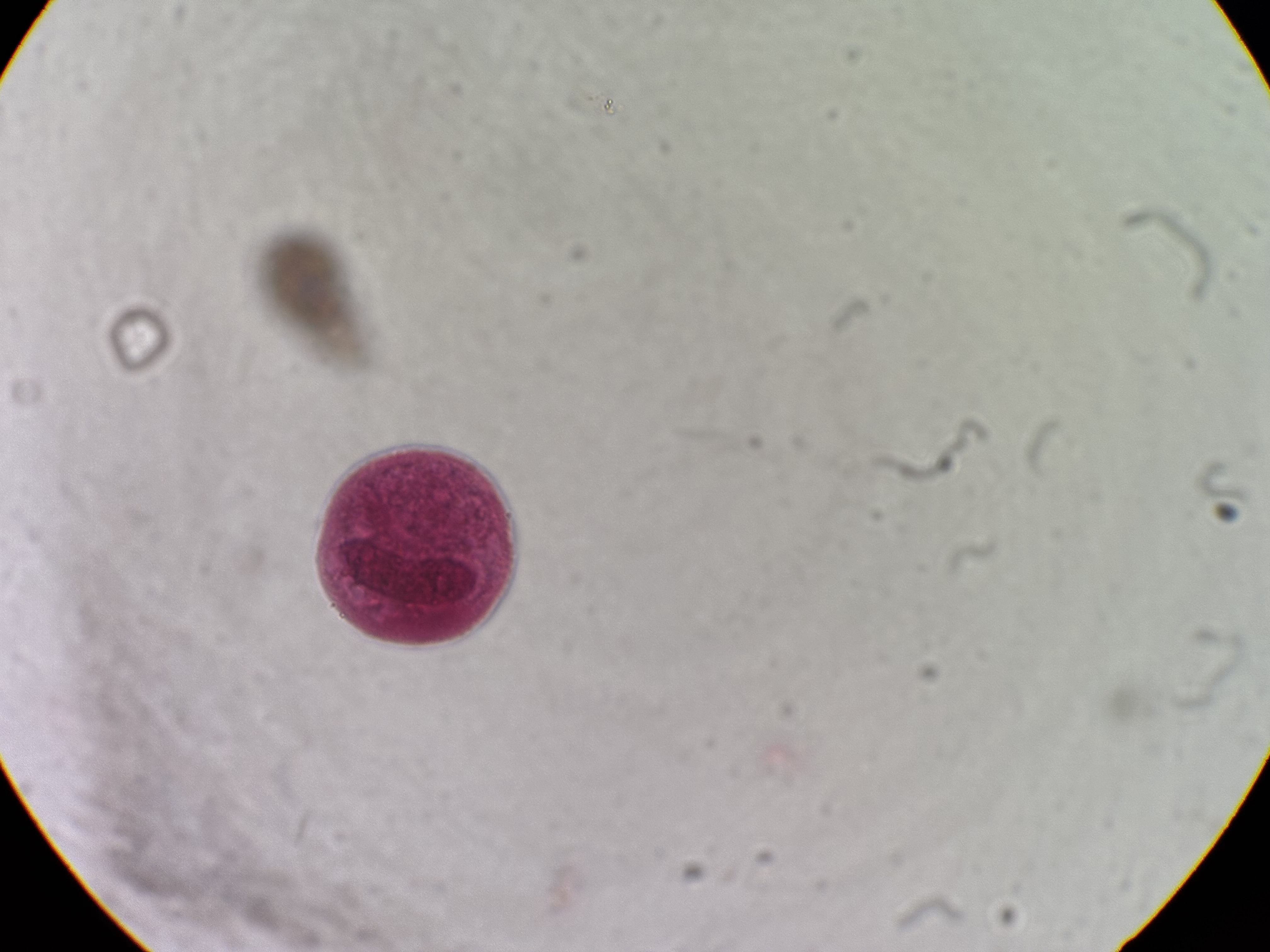 <p>Balantidium coli (cyst)</p>