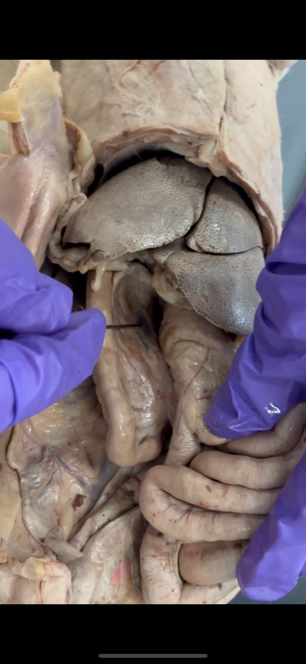 <p>Probe is pointing to clear area</p>