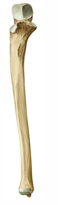 <p>Long bones</p>