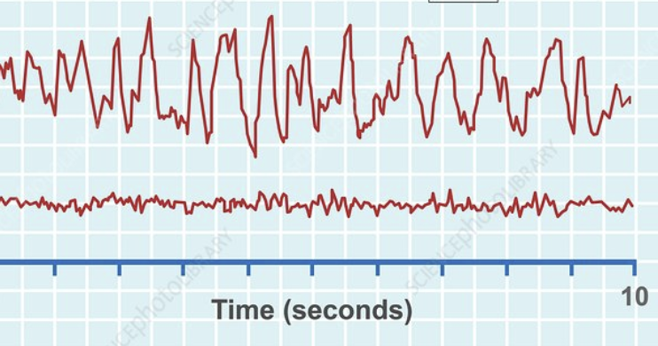 <p>Slow wave sleep (SWS)</p>