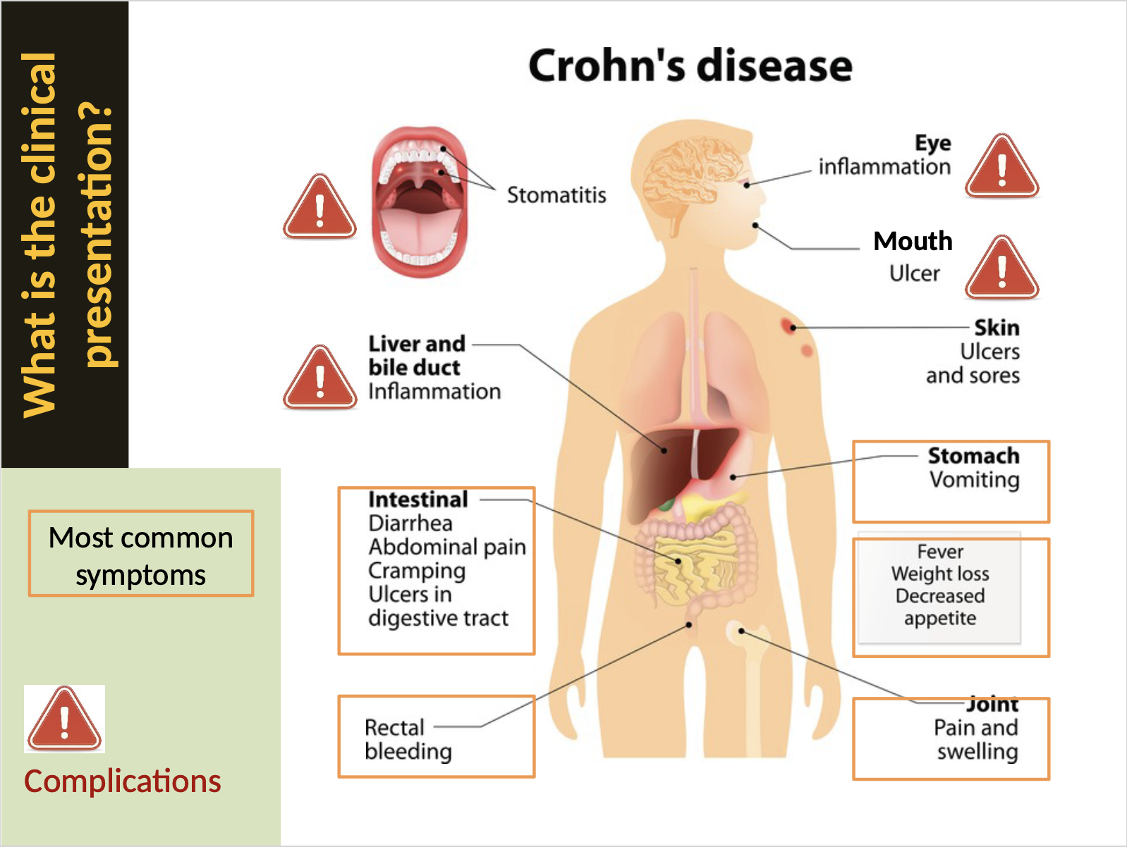 <p>Symptoms may include: </p><ul><li><p>abdominal pain</p></li><li><p>diarrhea</p></li><li><p>fatigue</p></li><li><p>malnutrition. </p></li></ul><p></p>