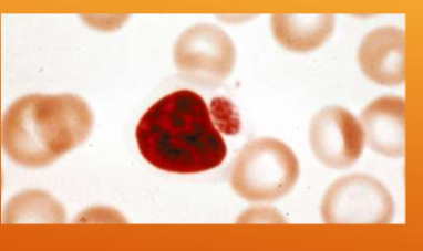 <p>what is&nbsp;<span style="color: rgb(255, 255, 255);"><span>Ehrlichia spp.; E. canis/E. ewingii spread by&nbsp;</span></span></p>