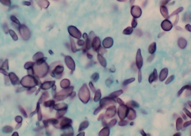 <p>Sporothrix schenckii yeast form</p>