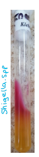 <p><strong>Kligler Agar:</strong></p><ul><li><p>Red</p></li><li><p>Yellow</p></li></ul><p></p>