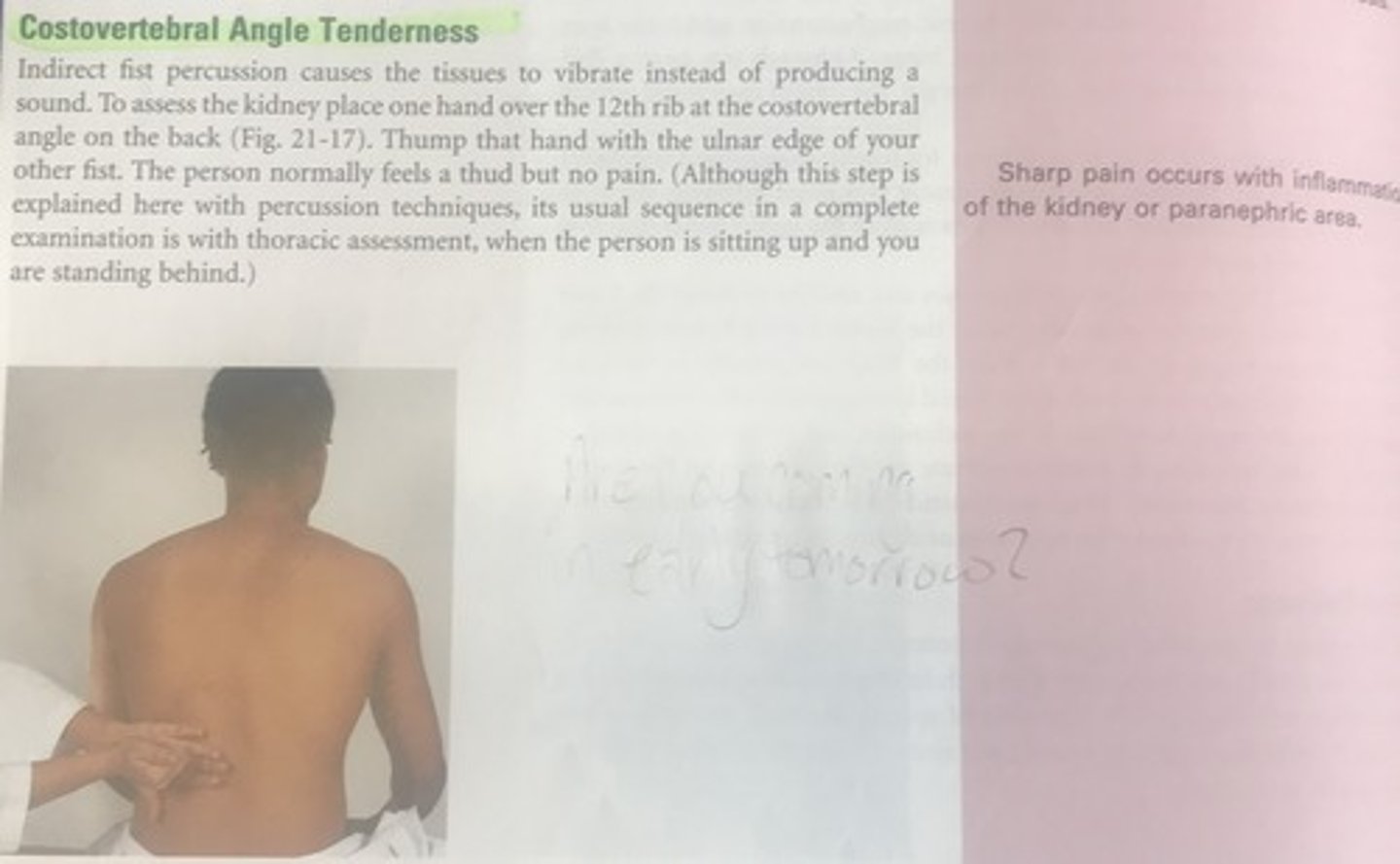 <p>C</p><p>Sharp pain along the costovertebral angles occurs with inflammation of the kidney or paranephric area. The other options are not correct</p>