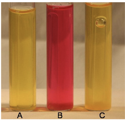 <p>what are the results of each tube</p>