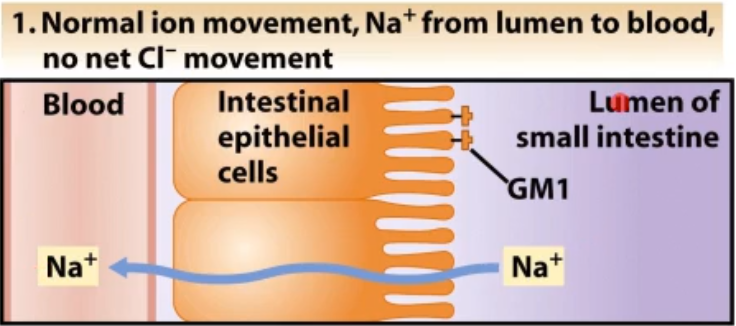 <p>the b subunit binds to GM1 which are glycolipids on the membrane of intestinal epithelial cells this causes a chain to activate adenylate cyclase which is an enzymes what converts ATP to cAMP which regulators cell compounds involved in ion balance. When cAMP levels go up, chloride ions are secreted to the lumen and water follows it into the lumen resulting int massive amounts of fluid loss and sever diarrhea</p><ol><li><p>messes with regulatory compounds for ion balance (increase in cAMP)</p></li><li><p>causes salts to leave the the blood instead of go into the blood</p></li><li><p>water flows the salt into the lumen of the small intestine (GI tract)</p></li><li><p>a lot of water loss</p></li></ol><p></p><p>*a representation of what normally happens in lumen of intestines is shown in picture </p>