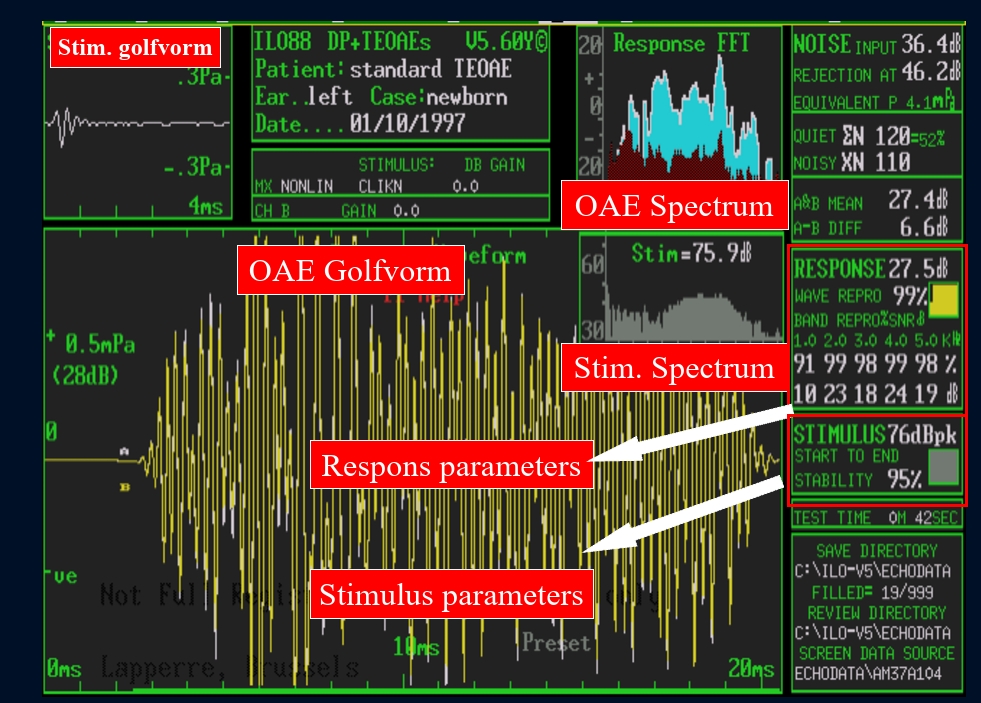 <p>groot/geel = oscillogram</p><p>→ fourier transformatie</p><p>→ spectrum</p>
