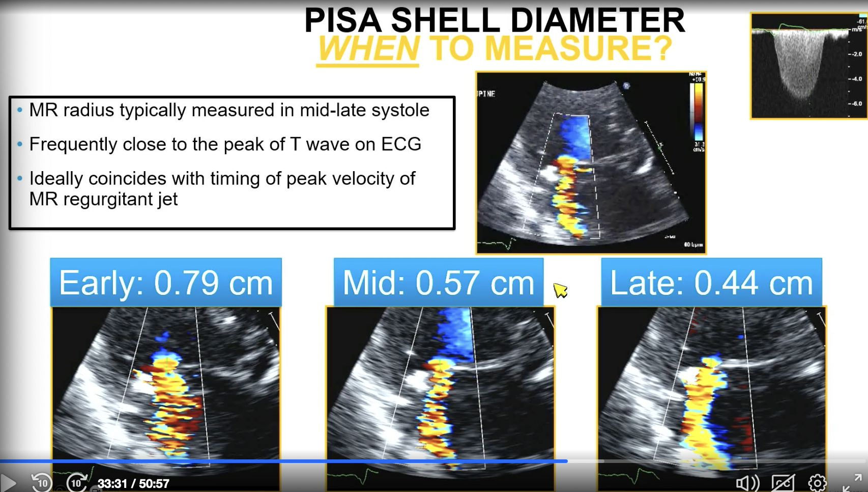 <p>You measure it in mid to late systole (close to the peak of the T wave)</p><p></p><p>FYI the image shows what happens if you don’t measure at the right time</p>
