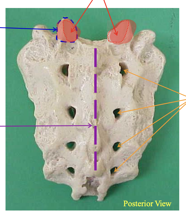 <p>Name the structure highlighted in red</p>