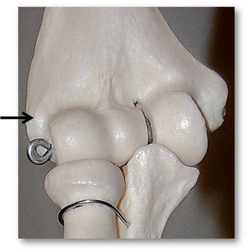 Name this specific part of the humerus.