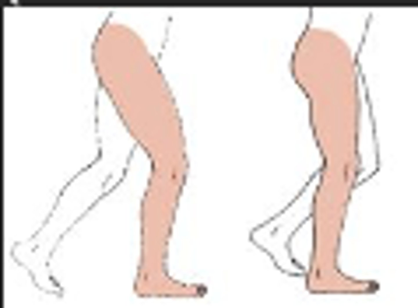 <p>12 - 30%</p><p>Begins at beginning of Single Limb Support and when Trunk is behind vertical line of ankle.</p><p>Ends when trunk is in front of vertical line of ankle and when heel rises (beginning of terminal stance</p><p>Important for Weight Acceptance</p>