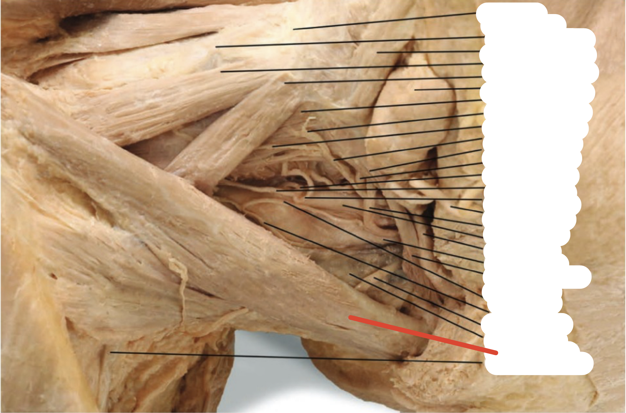 Identify the structure (red line)
