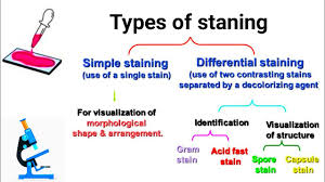 <p>What is the difference between a simple stain and a negative stain?</p>