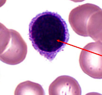 <p>type of white blood cell that fights infection</p>