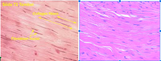 <ul><li><p>Characteristic: </p><ul><li><p><strong>WAVE-LOOKING</strong></p><ul><li><p>Made by FIBROBLASTS</p></li></ul></li><li><p>Tightly packed collagen Fibers</p></li></ul></li><li><p>Location: <strong>TENDONS AND LIGAMENTS </strong></p><ul><li><p>Tendons: Skeletal Muscle to Bones</p></li><li><p>Ligaments: Bone to Bone</p></li></ul></li><li><p>Function: <strong>MOVEMENT AND STABILITY</strong></p></li></ul><p></p>