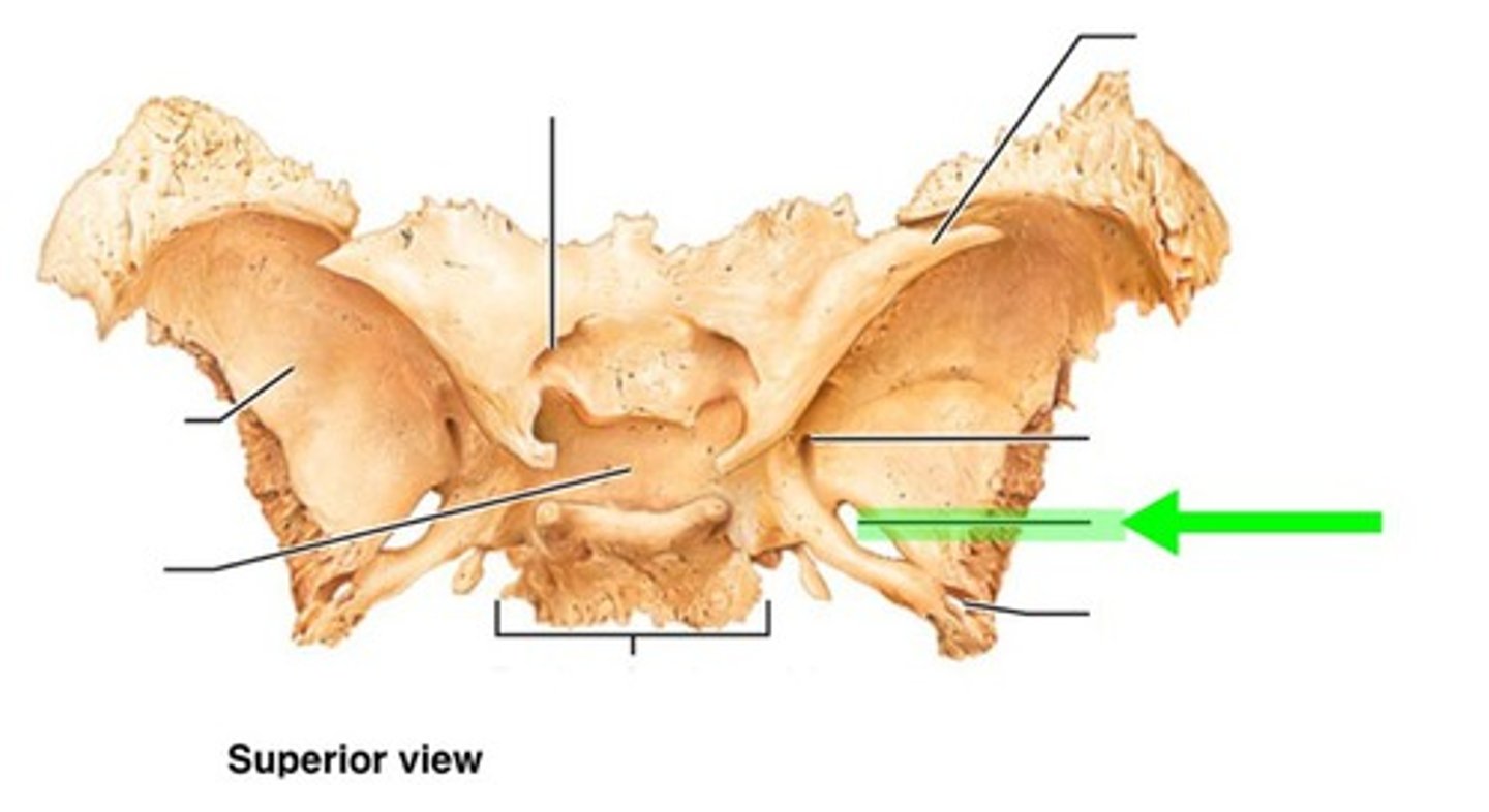 <p>mandibular branch CN V3 (of trigem) passes through</p>