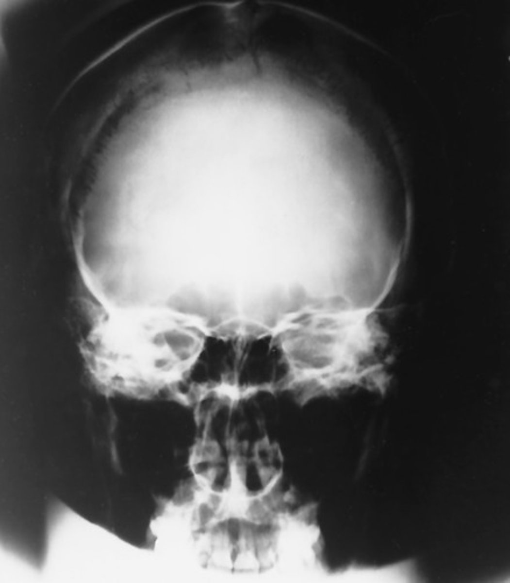 <p>Which position is this?</p>