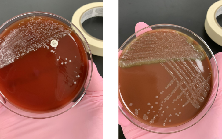 <p>this is from a respiratory culture so what would you do next</p>