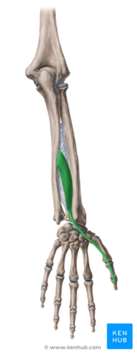 <p>Welke spier is dit?</p>