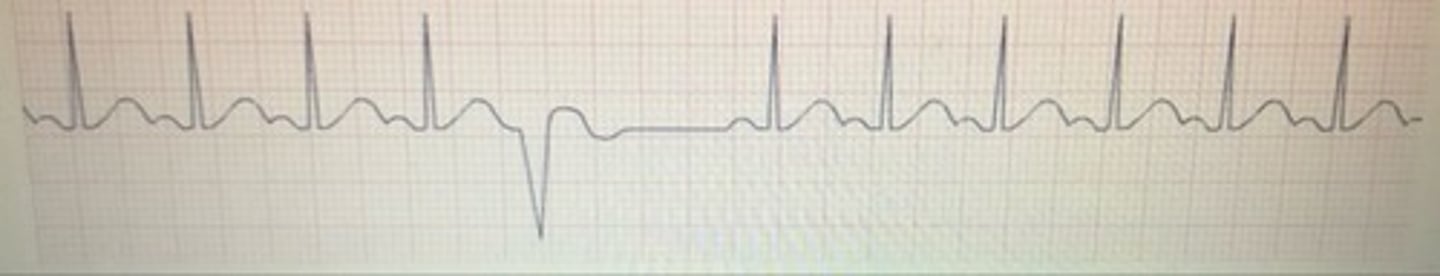 <p>What rhythm is this?</p>
