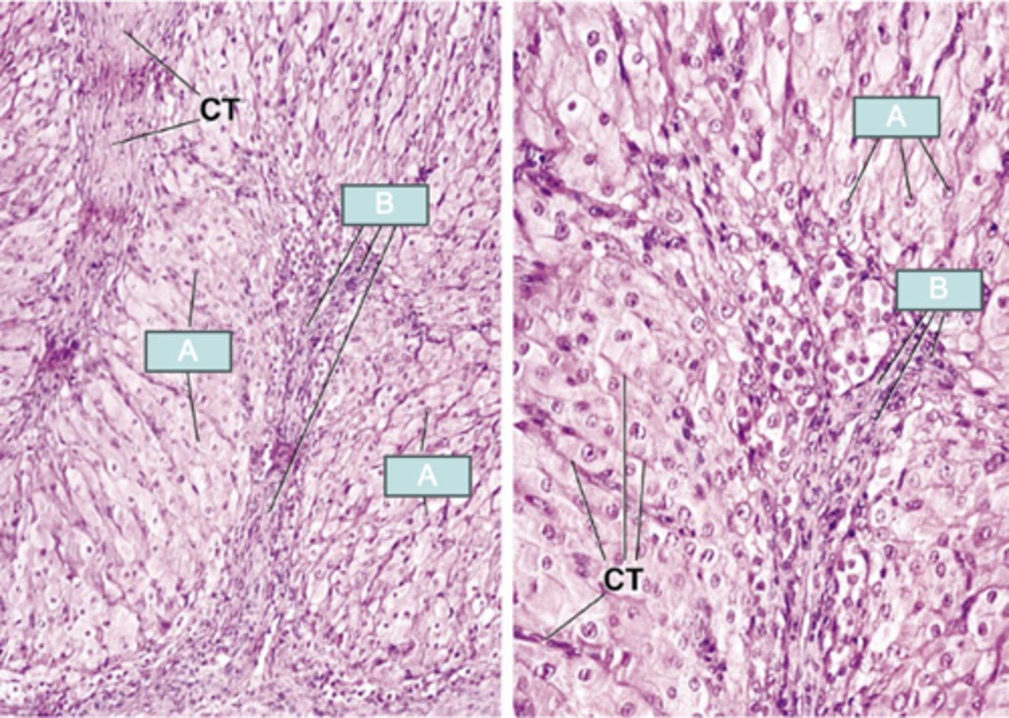<p>What corpus luteum cell type is B?</p>