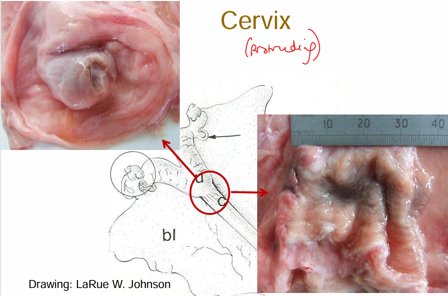<p>Has soft tissue protrusions into lumen of cervix </p>