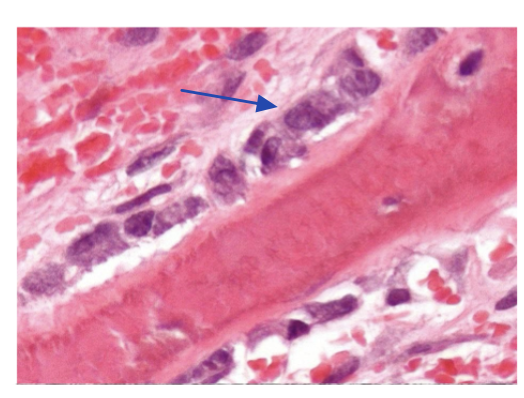 term image