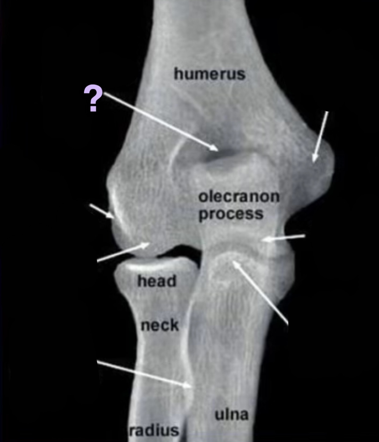 term image