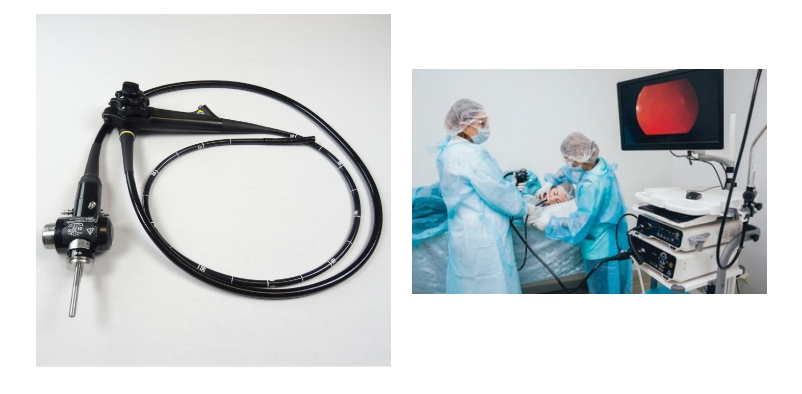 <p>direct visualization of body structure through an endoscope</p>