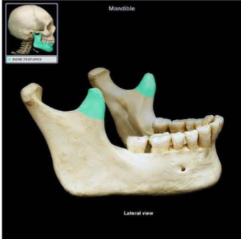 <p>Which mandibular marking is this? (2)</p>