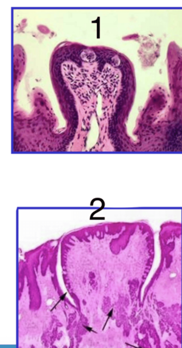 <p>which is fungiform and which is circumvallate?</p>