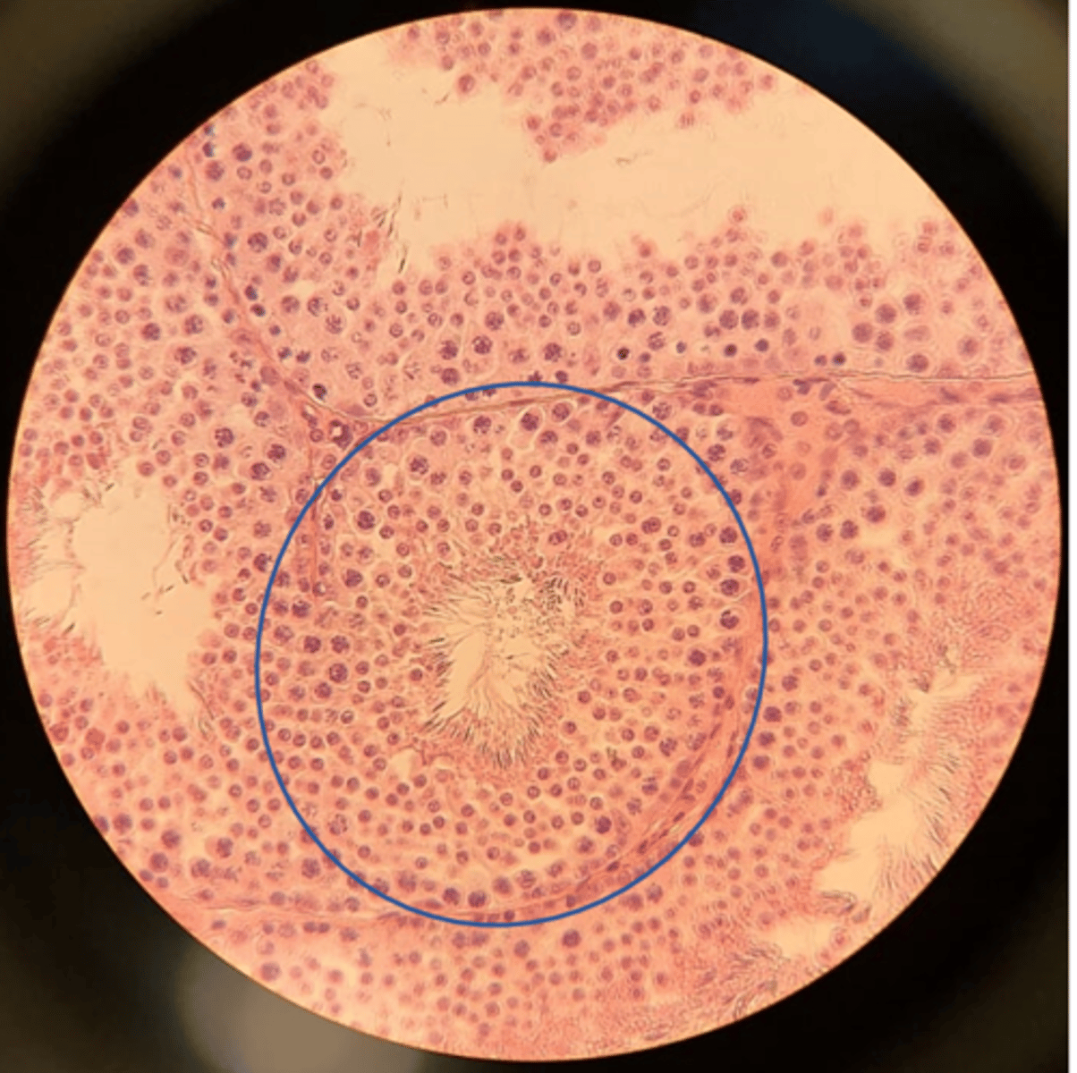 <p>What is the tube circled?</p>