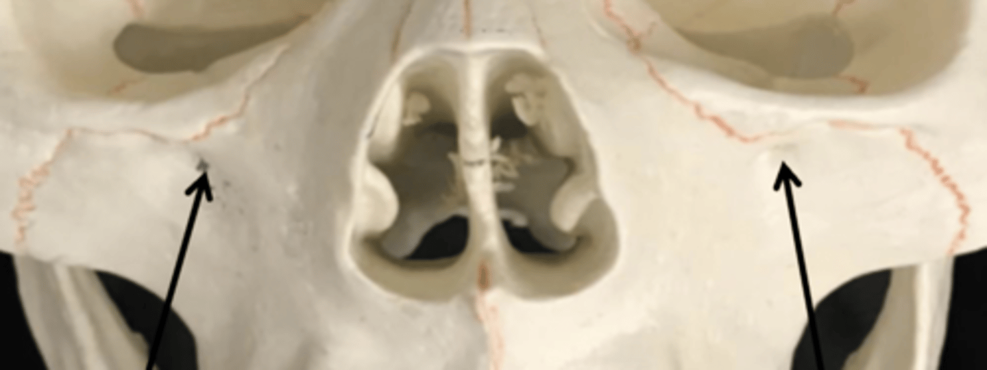 <p>the infraorbital foramen</p>
