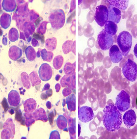 <ul><li><p><strong><u>Plasma cell tumor, lymphoma, Mast cell, Transmissible venereal tumor, Histiocytoma, Melanoma ±</u></strong></p></li><li><p>Discreet, small to medium-sized cells</p></li><li><p><strong><u>Exfoliate well</u></strong></p></li></ul><p></p>