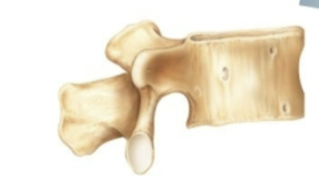 <p>What classification of bone is this?</p>