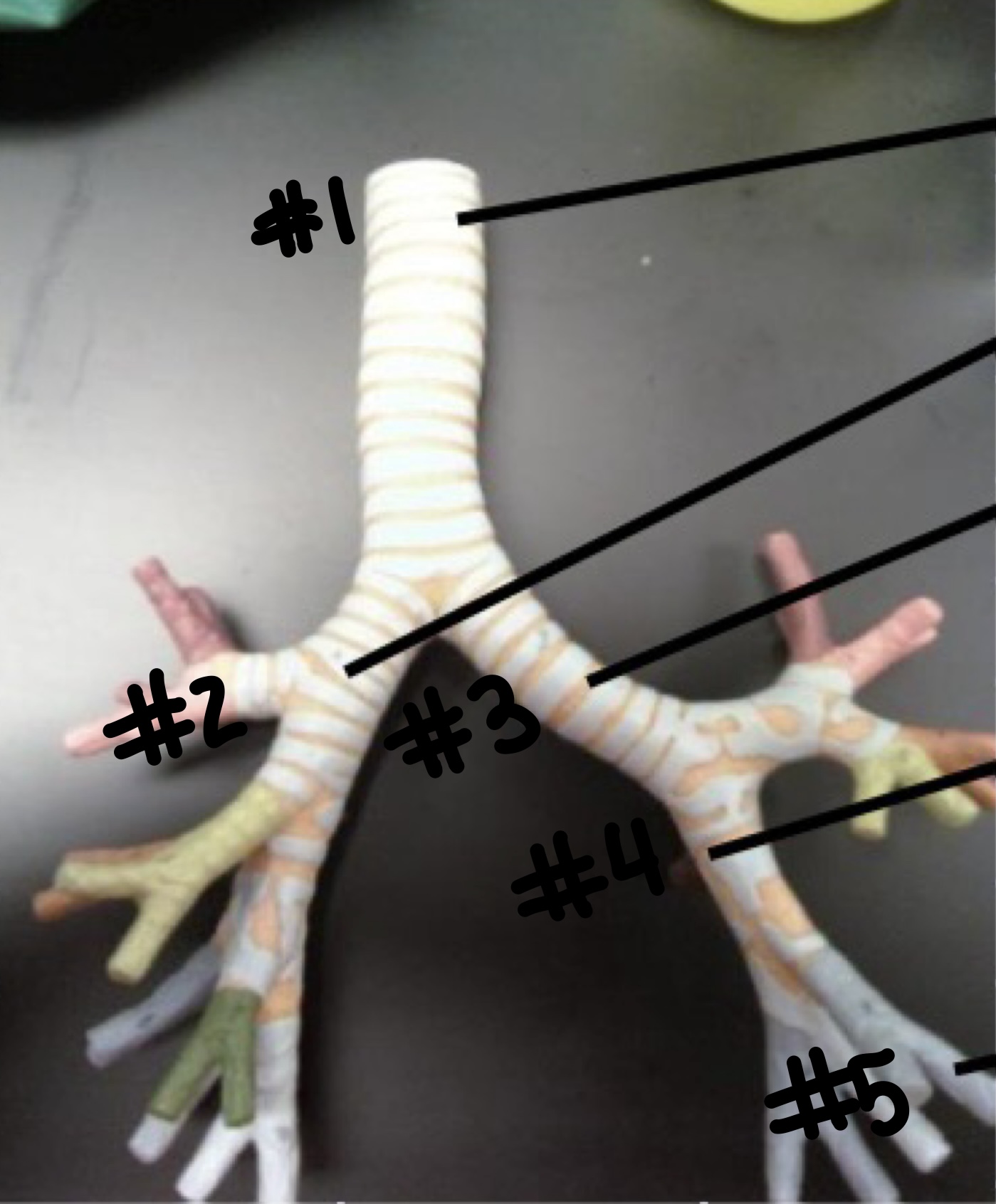 <p>Bronchial Tree</p>